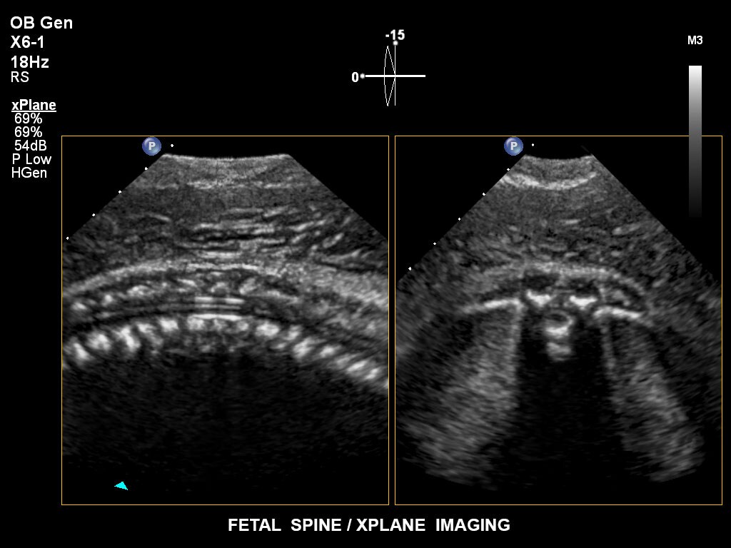 pregnancy ultrasound baby