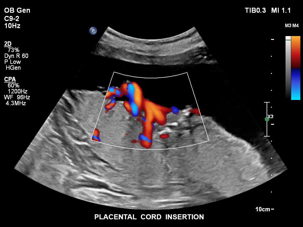 pregnancy ultrasound baby