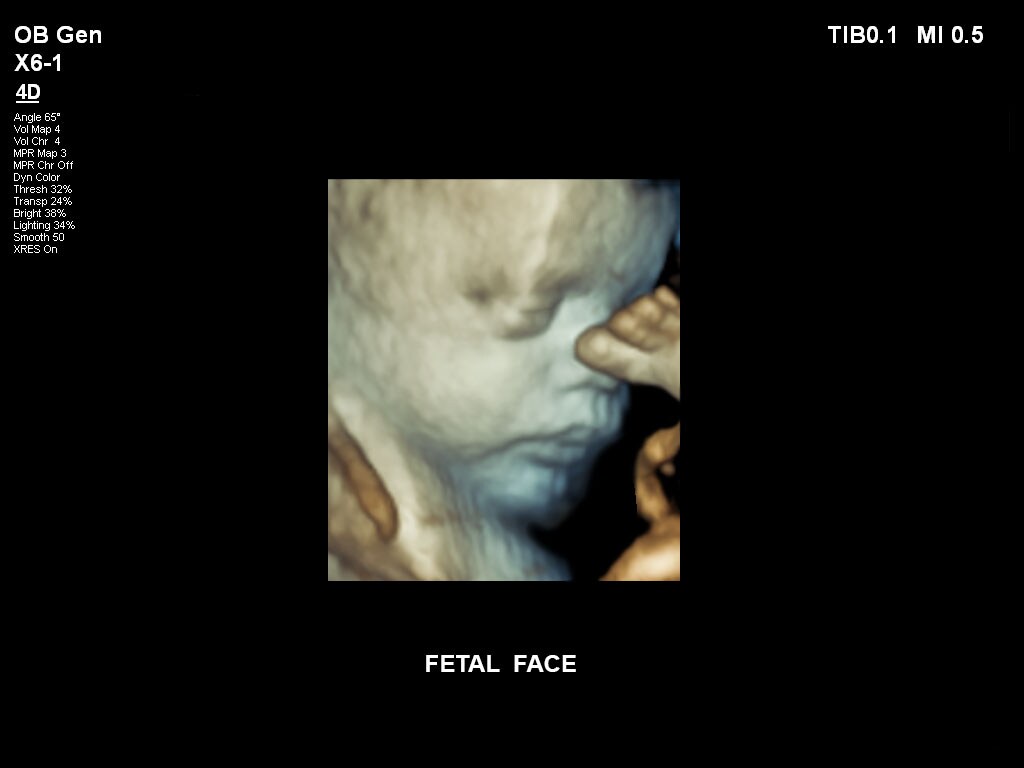 pregnancy ultrasound baby