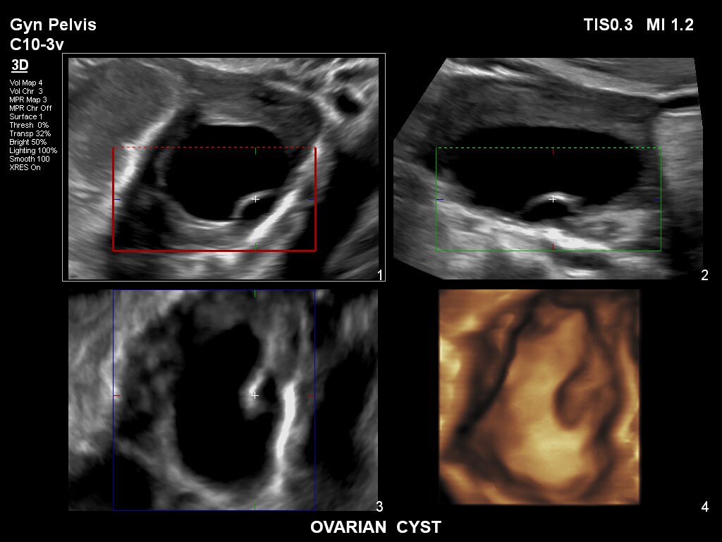 pregnancy ultrasound baby