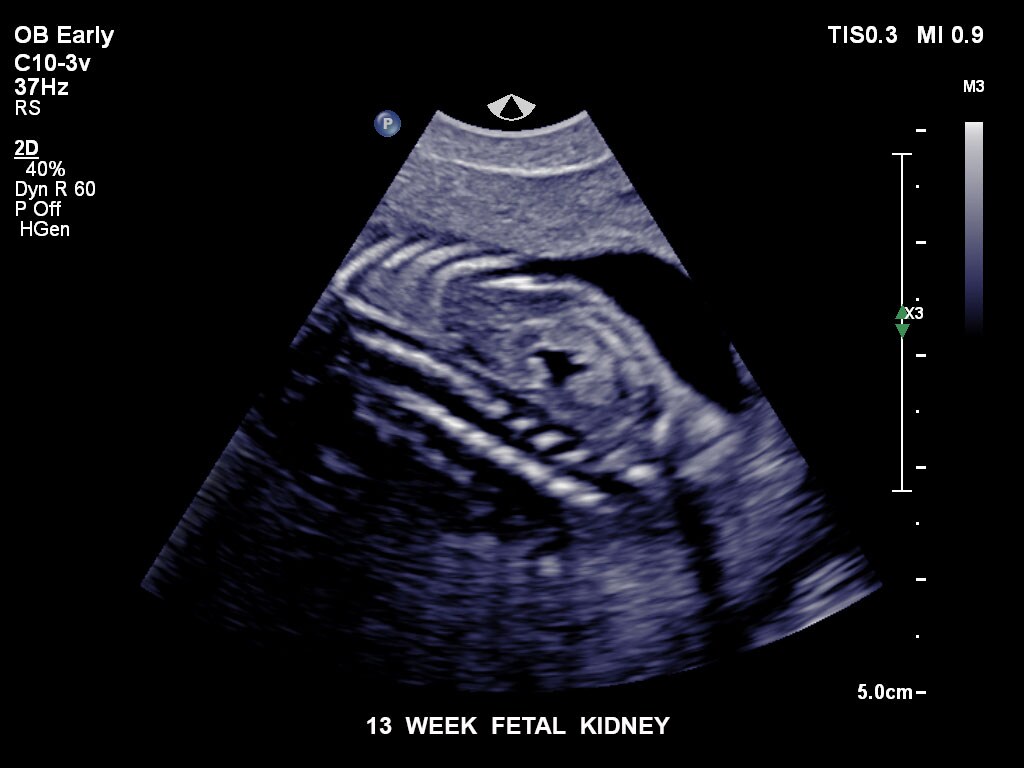 pregnancy ultrasound baby