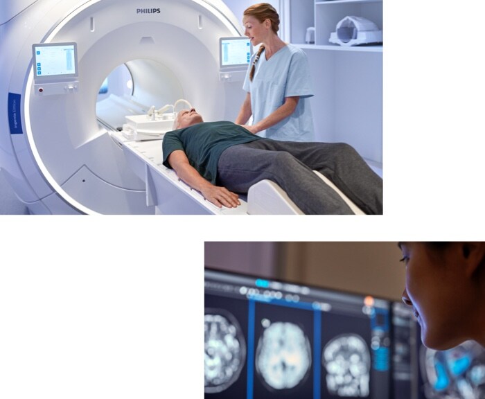 SmartExam MR automatically plans and scans the patient after you shut the door to speed stroke MRI scans 