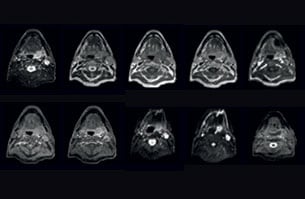 mri of head clinical case