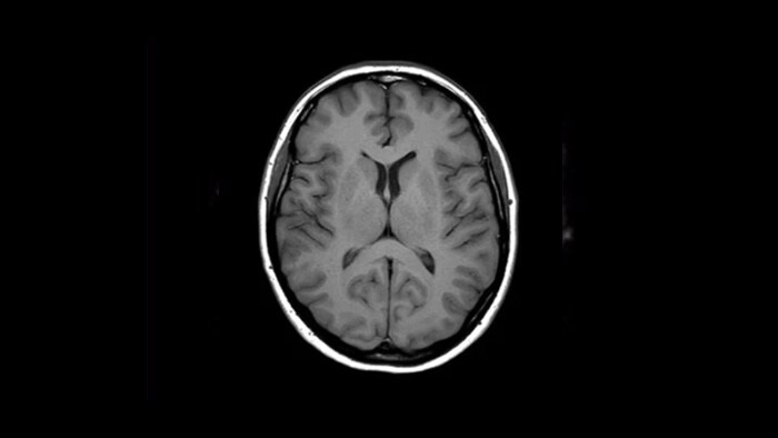 Brain clinical image