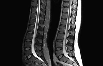 Spine image