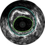 Calcific image