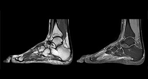 Lefebvre Case Ankle thumbnail