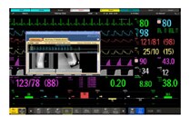 MX800 Monitor