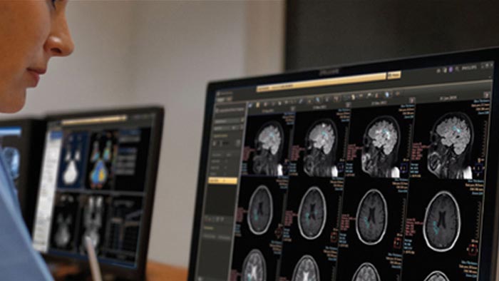 Philips showcases new connected innovations across the health continuum at Medic West Africa 2016